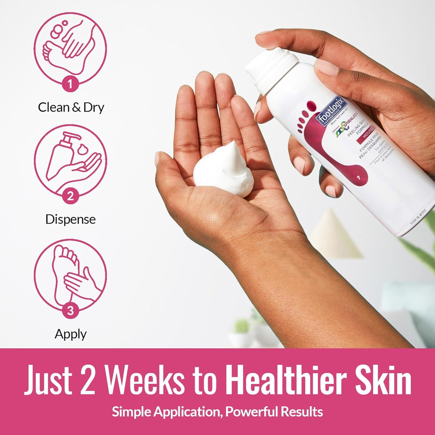 Footlogix - Peeling Skin Formula - 4.23oz / 125ml [Beauty]